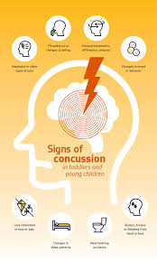 Image result for Concussion