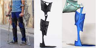 The Kafo Splint Is A Customizable Lightweight Fashionable And Functional Leg Brace Design Industrial Designer Or Steiner Gave Th Leg Braces Legs Braces