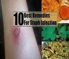 Maybe you would like to learn more about one of these? Staphylococcuss Causes Symptoms Treatment Diagnosis And Prevention Galleria Community Health And Lifestyle Nigeria