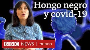 Your browser does not support html5 video. Hongo Negro Detectan Un Caso De Mucormicosis En Alguien Infectado Con Covid 19 En Uruguay Bbc News Mundo