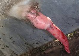 Image result for balanoposthitis