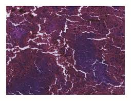 Image result for Pseudospondias