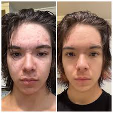 I recently purchased the Vitamin C serum and the copper peptide serum. I  noticed that the instructions say not to use them together. What do you  suggest for the time of day/order