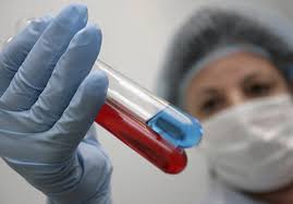Различают несколько геногрупп норовируса — g1, g2, g3, g4. Norovirusnaya Infekciya Simptomy Lechenie I Profilaktika