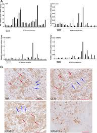 We did not find results for: Functional Analysis Of The Adrenomedullin Pathway In Malignant Pleural Mesothelioma Journal Of Thoracic Oncology