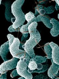 Porcine transmissible gastroenteritis (strain fs772/70). Explainer What Is Gastroenteritis And Why Can T I Get Rid Of It