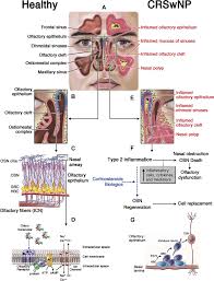 Image result for Drug-Induced Olfactory Dysfunction