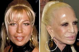 The Most Expensive Celebrity Plastic Surgeries Page 8 Modern News Fitness Bad Celebrity Plastic Surgery Celebrity Plastic Surgery Bad Plastic Surgeries