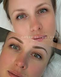 Image result for Erica microdonta