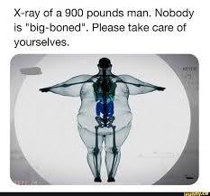 Is it possible to change the shape of a bone by applying a pressure to it  over a long period of time? How healthy would it be?