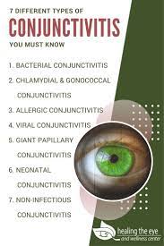 Different Types Of Conjunctivitis You Must Know Healing The Eye Conjunctivitis Common Eye Problems Psoriasis Skin
