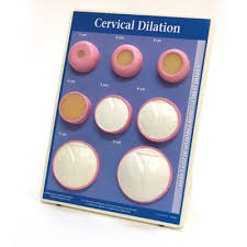 Molded Plastic Pregnancy Dilation Chart Childbirth Graphics