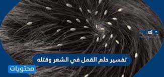 تفسير حلم القمل في الشعر وقتله لابن سيرين للحامل والمتزوجة والعزباء موقع محتويات