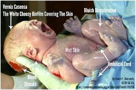The Neonates