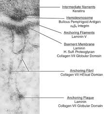 The epithelium is the cornea's outermost layer, and the basement membrane is the layer that the epithelium attaches to. Corneal Epithelial Adhesion Disorders Clinical Gate