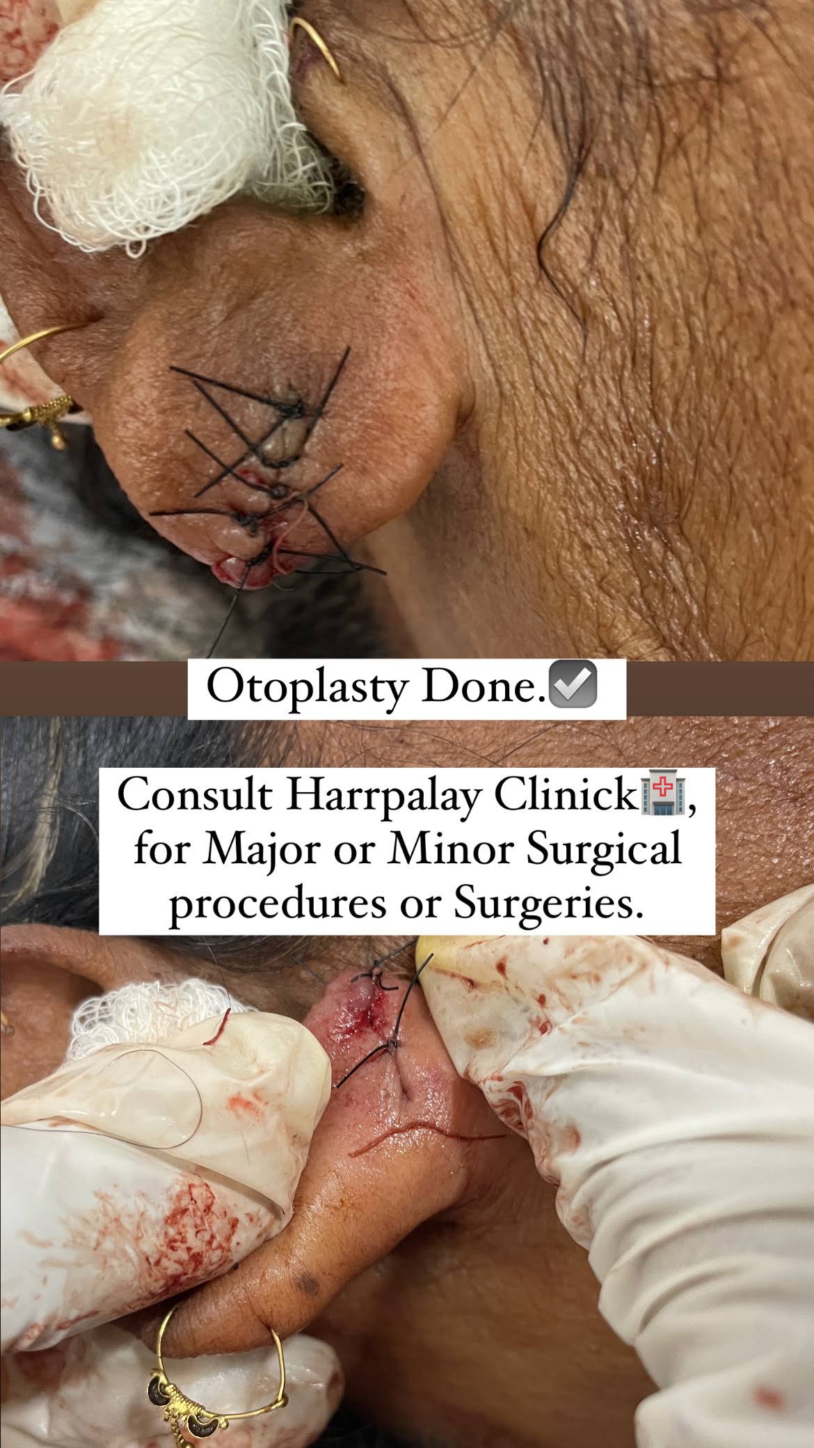 Surgical Procedures product image