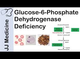 Image result for G6PD Deficiency Detection