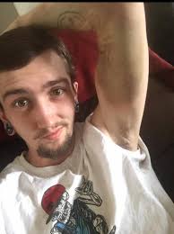 Dog's dew claw injury to owner