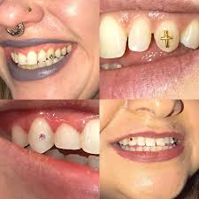 The cost of teeth jewellery depends on the design of the jewel and the quality of the material. Parity Real Diamond Tooth Gem Up To 67 Off