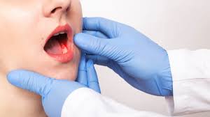 What can i do to prevent oral cancer? Oral Cancer Treatment In Delhi Everything You Need To Know
