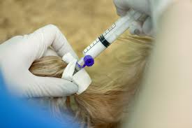 Image result for Hand Injection