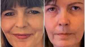 Fundraiser by Rebecca Everett : Emergency help for Erica's Rehab expenses