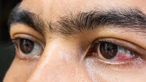 How to Improve Eyesight|आंखों का ख्याल कैसे रखें | Eyesight Kamjor Hone Ke  Lakshan