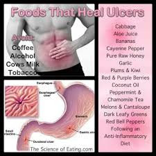 Foods That Heal Ulsers Ulcer Diet Foods For Ulcers Stomach Ulcer Remedies