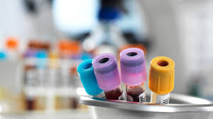 We did not find results for: Roche Doing Now What Patients Need Next