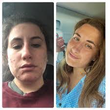 Hanna Rust's Instagram, Twitter & Facebook