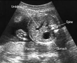 Pin On Ultrasounds