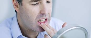 Wisdom teeth happen to be the last teeth to protrude from the gums. How To Handle A Toothache