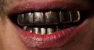 Teeth grillz: what they are, types, and prices 🦷