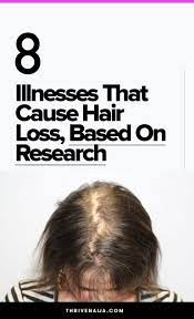 When it comes to the causes of hair loss, most people never suspect a vitamin d deficiency. 8 Illnesses That Cause Hair Loss Based On Research Thrivenaija Natural Hair Loss Hair Loss Natural Remedy Biotin For Hair Loss