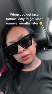 Right after the 2nd sesh @Removery Laser Tattoo Removal #lasertattooremoval  #tattooremoval #facetattoo #fyp