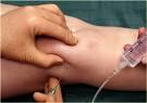 Tendinite - Quels sont les traitements prconiss contre ces