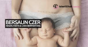 Sebab itu, pantang bersalin czer ini sangat penting dan perlu dititikberatkan dengan menjaga pemakanan diri sendiri dan bayi yang menyusu. Luka Czer Berdarah Archives Isterisihat Com My