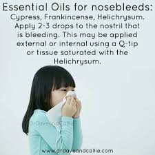 Pin On Young Living Oils