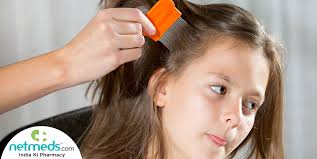 Home Remedies To Get Rid Of Head Lice