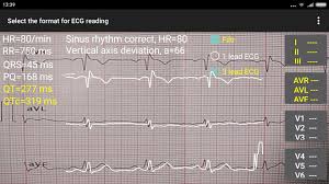 The zepp app, formerly known as amazfit, is the new official app for zepp and amazfit branded devices. Ecg Reader 2 Free For Android Apk Download