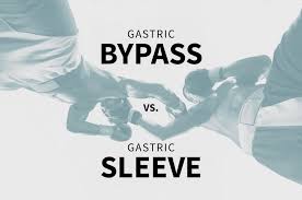 gastric bypass vs gastric sleeve surgery