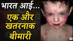भारत आई कोरोना से जुड़ी बच्चों की बीमारी, ये लक्षण न करें इग्नोर - YouTube
