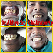 Smile N Rehab in Debra,Midnapore