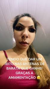 Queda De Cabelo Pós Parto O Que Ajuda