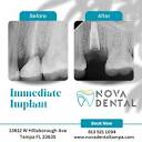 Nova Dental(@novadental) • Instagram 사진 및 동영상