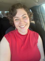 What does a no gap smile look like