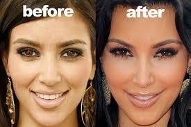 Since it specifically works on heating up the melanin in your hair, it does not have any effect on the surrounding skin. The Importance Of Kim K S Hairline