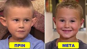 6χρονο παιδί που δεχόταν επί χρόνια bullying για τα αυτιά του που έμοιαζαν  με ξωτικού, κάνει πλαστική επέμβαση και γίνεται αγνώριστο