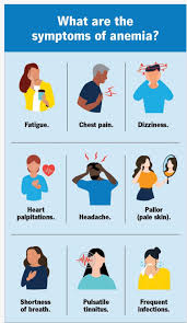 Image result for Anemia simii