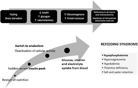 Image result for Refeeding Syndrome